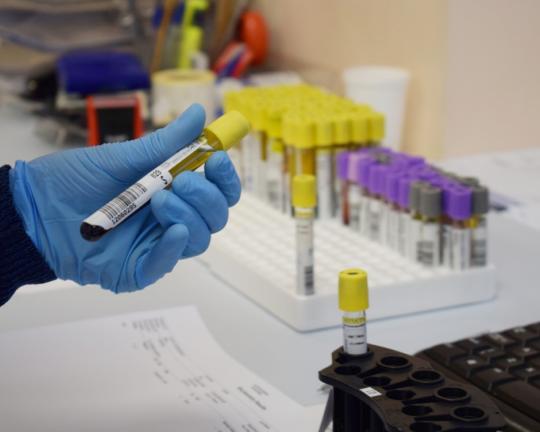 Informacija dėl laboratorinių tyrimų